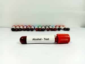 Test Tube with blood sample for Alcohol test. A medical testing concept in the laboratory background.