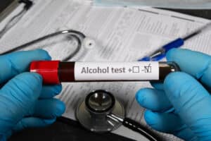 Medical Conditions Affect DUI Test